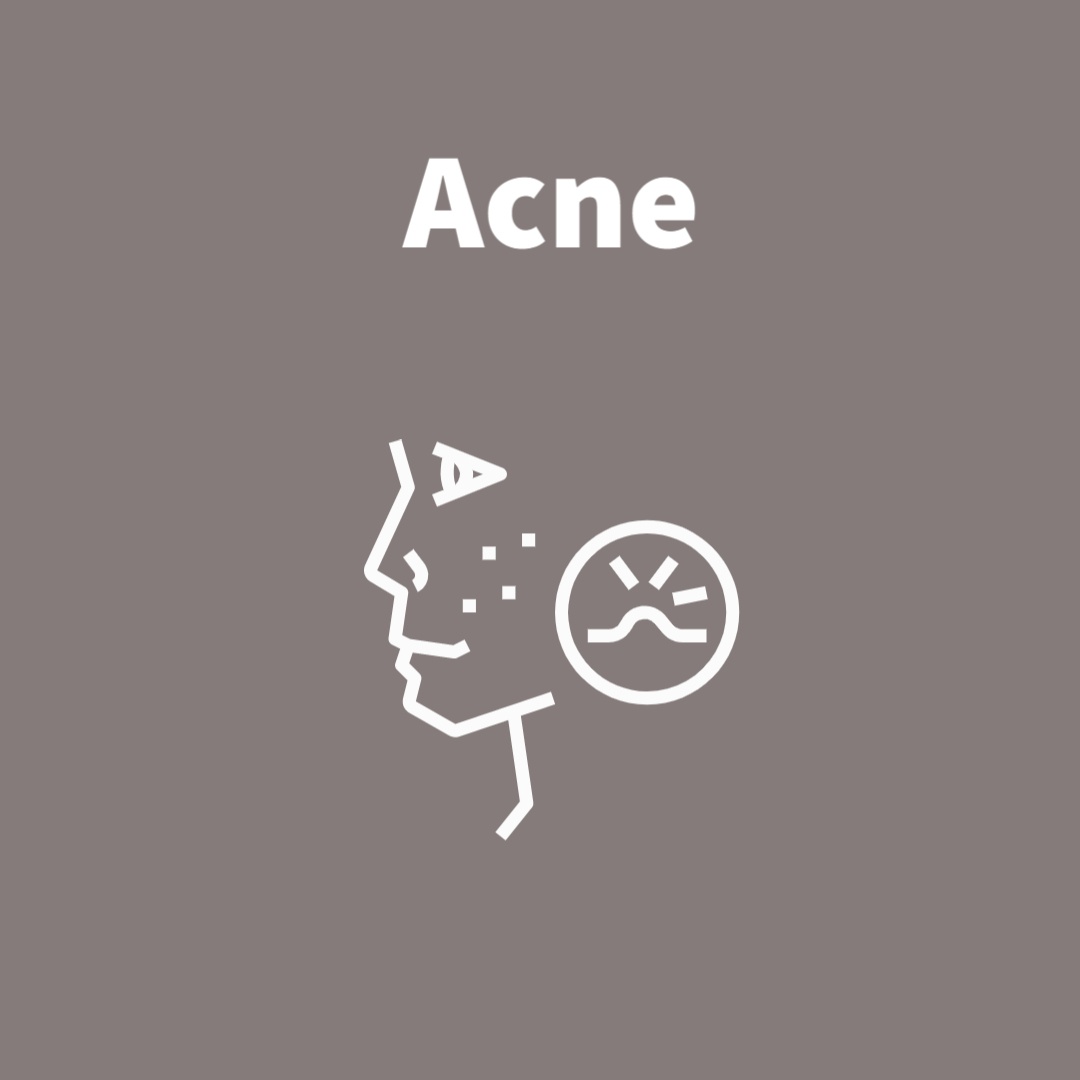 Acne