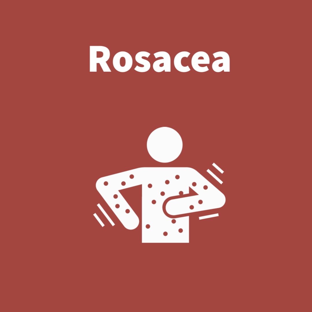 Rosacea