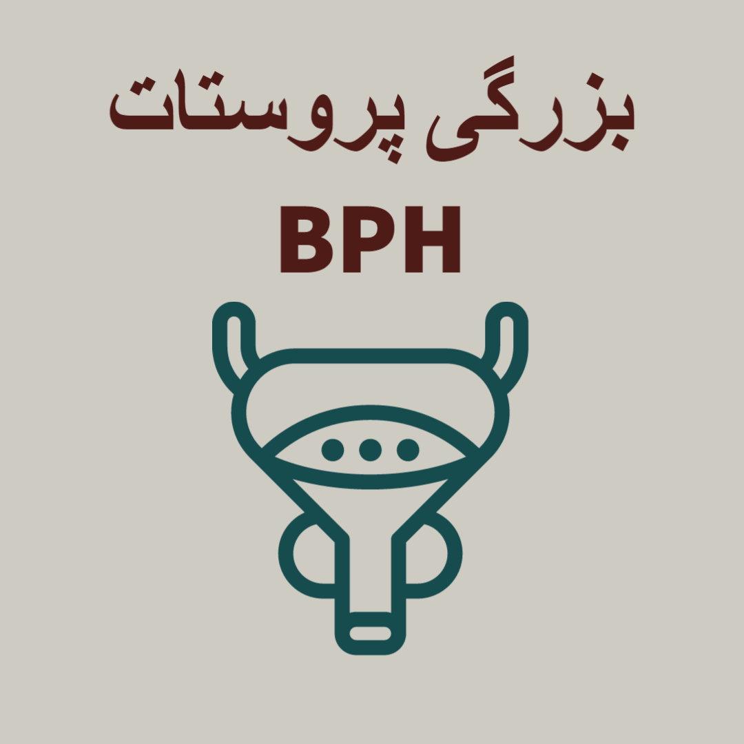 بزرگی پروستات BPH